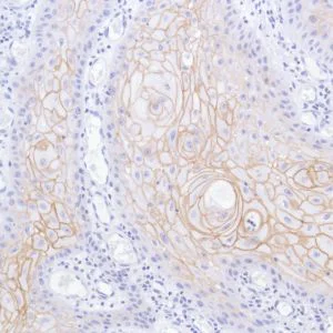 Immunohistochemistry (Formalin/PFA-fixed paraffin-embedded sections) - Anti-TROP2 antibody [SP293] - BSA and Azide free (AB272014)