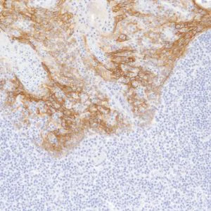 Immunohistochemistry (Formalin/PFA-fixed paraffin-embedded sections) - Anti-TROP2 antibody [SP293] - BSA and Azide free (AB272014)