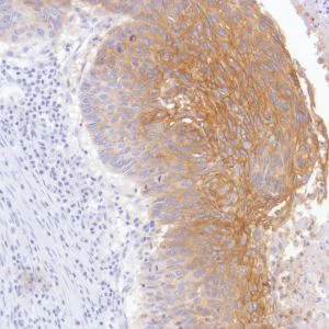 Immunohistochemistry (Formalin/PFA-fixed paraffin-embedded sections) - Anti-TROP2 antibody [SP293] - BSA and Azide free (AB272014)