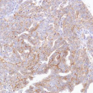 Immunohistochemistry (Formalin/PFA-fixed paraffin-embedded sections) - Anti-TROP2 antibody [SP293] - BSA and Azide free (AB272014)