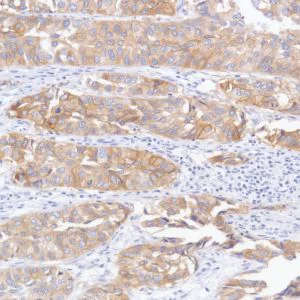 Immunohistochemistry (Formalin/PFA-fixed paraffin-embedded sections) - Anti-TROP2 antibody [SP293] - BSA and Azide free (AB272014)