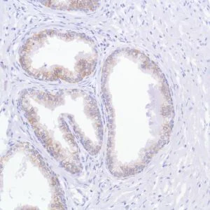 Immunohistochemistry (Formalin/PFA-fixed paraffin-embedded sections) - Anti-TROP2 antibody [SP293] - BSA and Azide free (AB272014)