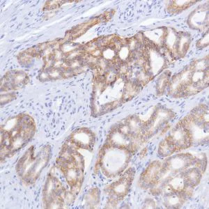 Immunohistochemistry (Formalin/PFA-fixed paraffin-embedded sections) - Anti-TROP2 antibody [SP293] - BSA and Azide free (AB272014)