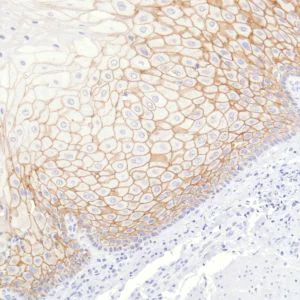 Immunohistochemistry (Formalin/PFA-fixed paraffin-embedded sections) - Anti-TROP2 antibody [SP293] - BSA and Azide free (AB272014)