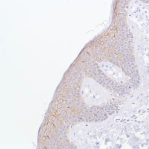 Immunohistochemistry (Formalin/PFA-fixed paraffin-embedded sections) - Anti-TROP2 antibody [SP293] - BSA and Azide free (AB272014)