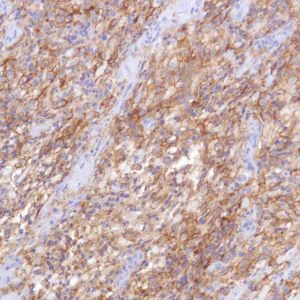 Immunohistochemistry (Formalin/PFA-fixed paraffin-embedded sections) - Anti-TROP2 antibody [SP293] - BSA and Azide free (AB272014)