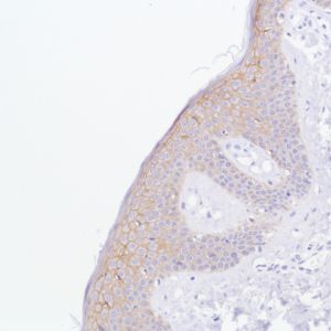 Immunohistochemistry (Formalin/PFA-fixed paraffin-embedded sections) - Anti-TROP2 antibody [SP293] - C-terminal (AB227689)