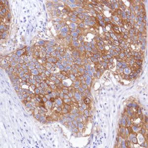 Immunohistochemistry (Formalin/PFA-fixed paraffin-embedded sections) - Anti-TROP2 antibody [SP294] - BSA and Azide free (AB238789)