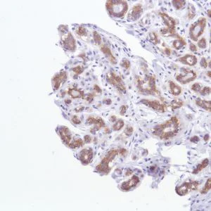 Immunohistochemistry (Formalin/PFA-fixed paraffin-embedded sections) - Anti-TROP2 antibody [SP294] - BSA and Azide free (AB238789)