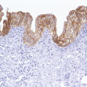 Immunohistochemistry (Formalin/PFA-fixed paraffin-embedded sections) - Anti-TROP2 antibody [SP294] - BSA and Azide free (AB238789)