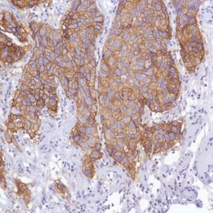 Immunohistochemistry (Formalin/PFA-fixed paraffin-embedded sections) - Anti-TROP2 antibody [SP294] - BSA and Azide free (AB238789)