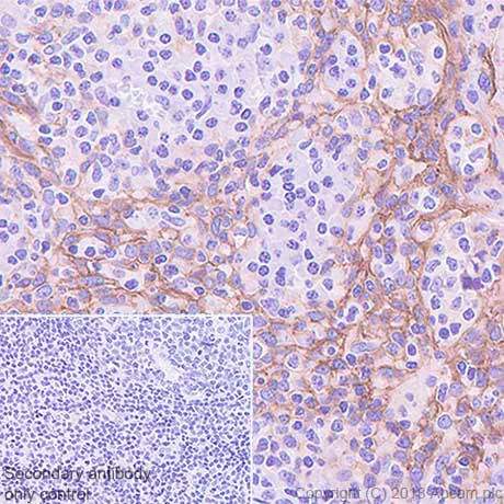 Immunohistochemistry (Formalin/PFA-fixed paraffin-embedded sections) - Anti-TROP2 antibody [SP294] - BSA and Azide free (AB238789)