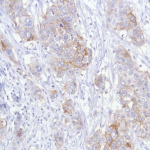 Immunohistochemistry (Formalin/PFA-fixed paraffin-embedded sections) - Anti-TROP2 antibody [SP294] - BSA and Azide free (AB238789)