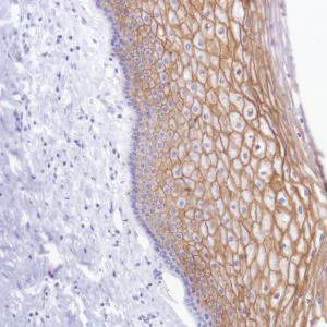 Immunohistochemistry (Formalin/PFA-fixed paraffin-embedded sections) - Anti-TROP2 antibody [SP294] - BSA and Azide free (AB238789)
