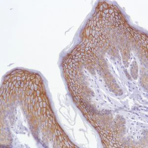 Immunohistochemistry (Formalin/PFA-fixed paraffin-embedded sections) - Anti-TROP2 antibody [SP294] - BSA and Azide free (AB238789)