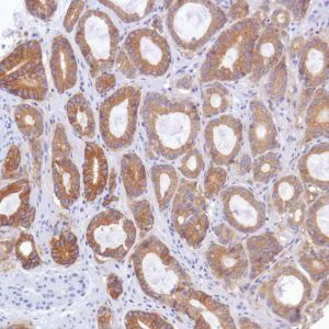 Immunohistochemistry (Formalin/PFA-fixed paraffin-embedded sections) - Anti-TROP2 antibody [SP294] - BSA and Azide free (AB238789)