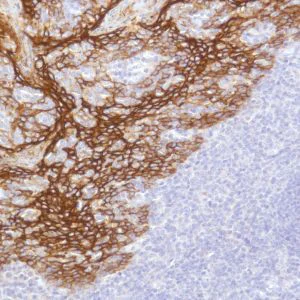 Immunohistochemistry (Formalin/PFA-fixed paraffin-embedded sections) - Anti-TROP2 antibody [SP294] - BSA and Azide free (AB238789)