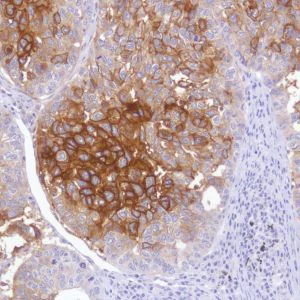 Immunohistochemistry (Formalin/PFA-fixed paraffin-embedded sections) - Anti-TROP2 antibody [SP294] - BSA and Azide free (AB238789)