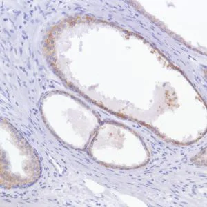 Immunohistochemistry (Formalin/PFA-fixed paraffin-embedded sections) - Anti-TROP2 antibody [SP294] - BSA and Azide free (AB238789)