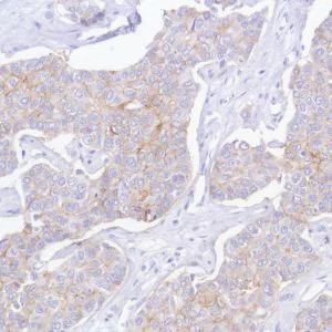 Immunohistochemistry (Formalin/PFA-fixed paraffin-embedded sections) - Anti-TROP2 antibody [SP294] - BSA and Azide free (AB238789)