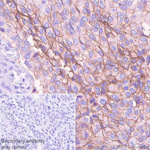 Immunohistochemistry (Formalin/PFA-fixed paraffin-embedded sections) - Anti-TROP2 antibody [SP294] - BSA and Azide free (AB238789)