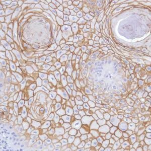 Immunohistochemistry (Formalin/PFA-fixed paraffin-embedded sections) - Anti-TROP2 antibody [SP294] - BSA and Azide free (AB238789)