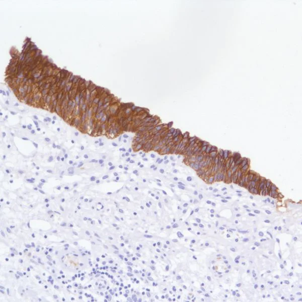 Immunohistochemistry (Formalin/PFA-fixed paraffin-embedded sections) - Anti-TROP2 antibody [SP295] (AB227691)