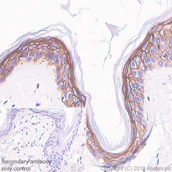 Immunohistochemistry (Formalin/PFA-fixed paraffin-embedded sections) - Anti-TROP2 antibody [SP295] (AB227691)