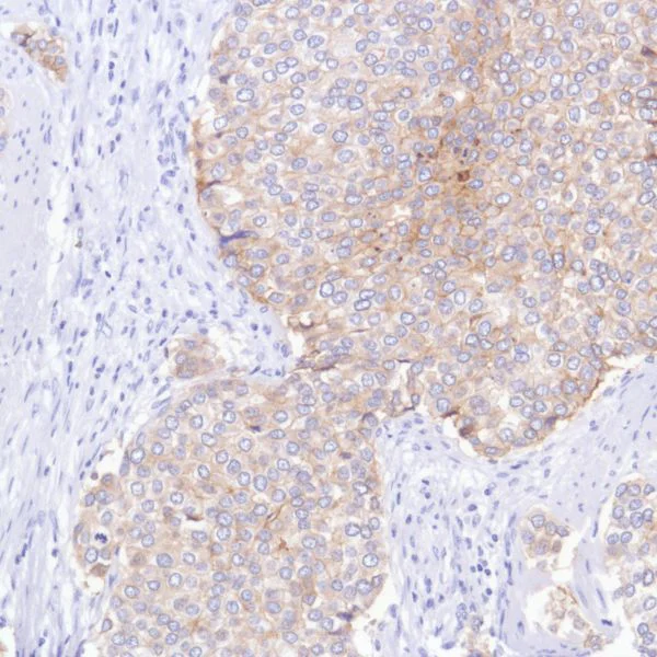 Immunohistochemistry (Formalin/PFA-fixed paraffin-embedded sections) - Anti-TROP2 antibody [SP295] (AB227691)