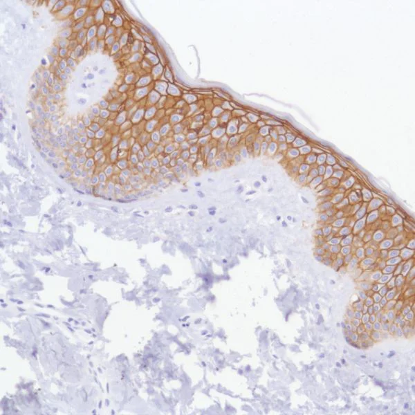 Immunohistochemistry (Formalin/PFA-fixed paraffin-embedded sections) - Anti-TROP2 antibody [SP295] (AB227691)