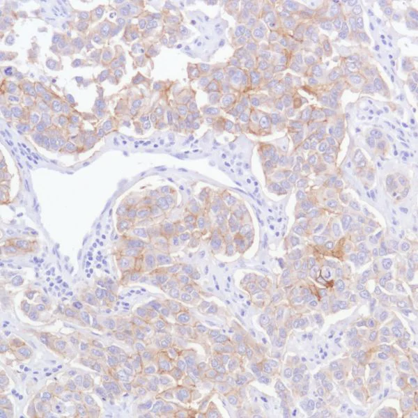 Immunohistochemistry (Formalin/PFA-fixed paraffin-embedded sections) - Anti-TROP2 antibody [SP295] (AB227691)