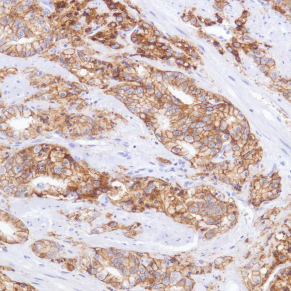 Immunohistochemistry (Formalin/PFA-fixed paraffin-embedded sections) - Anti-TROP2 antibody [SP295] (AB227691)