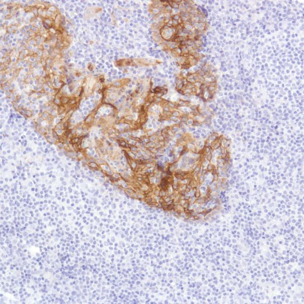 Immunohistochemistry (Formalin/PFA-fixed paraffin-embedded sections) - Anti-TROP2 antibody [SP295] (AB227691)