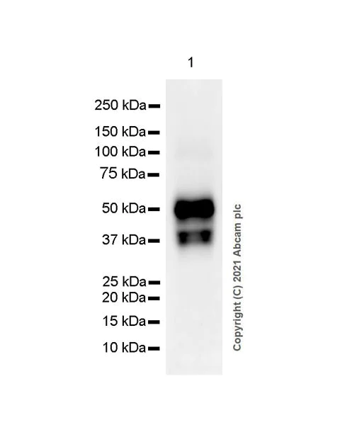 Western blot - Anti-TROP2 antibody [SP295] (AB227691)