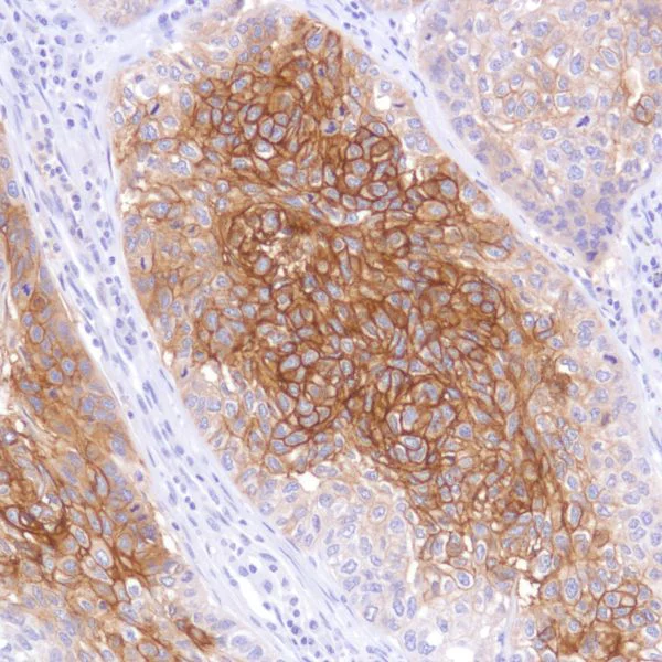 Immunohistochemistry (Formalin/PFA-fixed paraffin-embedded sections) - Anti-TROP2 antibody [SP295] - BSA and Azide free (AB238791)