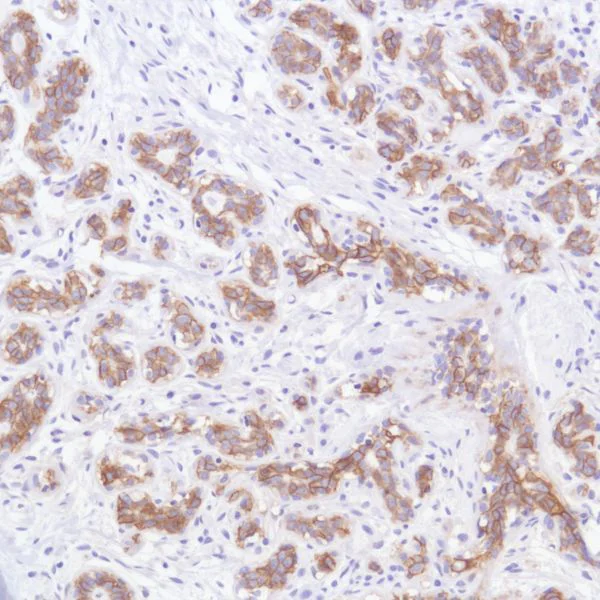 Immunohistochemistry (Formalin/PFA-fixed paraffin-embedded sections) - Anti-TROP2 antibody [SP295] - BSA and Azide free (AB238791)