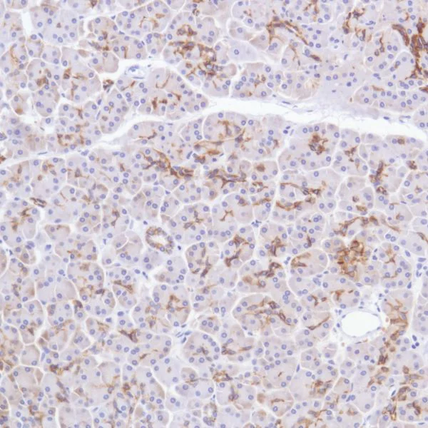 Immunohistochemistry (Formalin/PFA-fixed paraffin-embedded sections) - Anti-TROP2 antibody [SP295] - BSA and Azide free (AB238791)