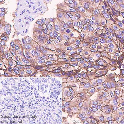 Immunohistochemistry (Formalin/PFA-fixed paraffin-embedded sections) - Anti-TROP2 antibody [SP295] - BSA and Azide free (AB238791)