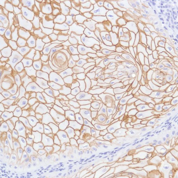 Immunohistochemistry (Formalin/PFA-fixed paraffin-embedded sections) - Anti-TROP2 antibody [SP295] - BSA and Azide free (AB238791)