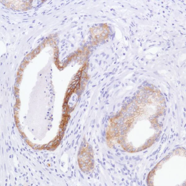 Immunohistochemistry (Formalin/PFA-fixed paraffin-embedded sections) - Anti-TROP2 antibody [SP295] - BSA and Azide free (AB238791)