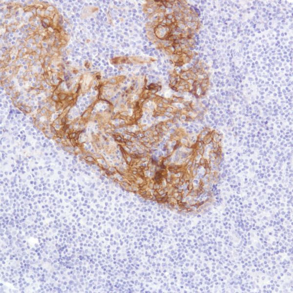 Immunohistochemistry (Formalin/PFA-fixed paraffin-embedded sections) - Anti-TROP2 antibody [SP295] - BSA and Azide free (AB238791)
