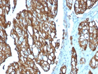 Immunohistochemistry (Formalin/PFA-fixed paraffin-embedded sections) - Anti-TROP2 antibody [TACSTD2/2151] (AB238015)