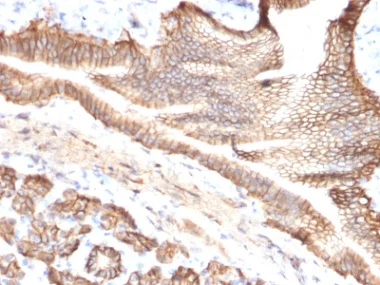 Immunohistochemistry (Formalin/PFA-fixed paraffin-embedded sections) - Anti-TROP2 antibody [TACSTD2/2151] (AB238015)