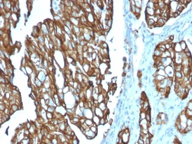 Immunohistochemistry (Formalin/PFA-fixed paraffin-embedded sections) - Anti-TROP2 antibody [TACSTD2/2151] - BSA and Azide free (AB237859)