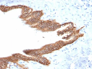 Immunohistochemistry (Formalin/PFA-fixed paraffin-embedded sections) - Anti-TROP2 antibody [TACSTD2/2152] - BSA and Azide free (AB237860)