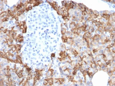 Immunohistochemistry (Formalin/PFA-fixed paraffin-embedded sections) - Anti-TROP2 antibody [TACSTD2/2152] - BSA and Azide free (AB237860)