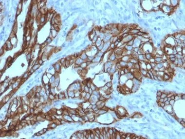 Immunohistochemistry (Formalin/PFA-fixed paraffin-embedded sections) - Anti-TROP2 antibody [TACSTD2/2152] - BSA and Azide free (AB237860)