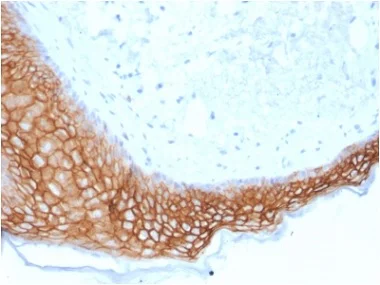 Immunohistochemistry (Formalin/PFA-fixed paraffin-embedded sections) - Anti-TROP2 antibody [TACSTD2/2153] (AB238017)