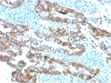 Immunohistochemistry (Formalin/PFA-fixed paraffin-embedded sections) - Anti-TROP2 antibody [TACSTD2/2153] - BSA and Azide free (AB237861)