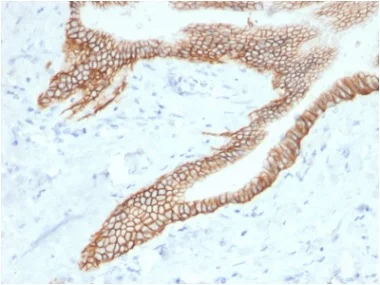 Immunohistochemistry (Formalin/PFA-fixed paraffin-embedded sections) - Anti-TROP2 antibody [TACSTD2/2153] - BSA and Azide free (AB237861)